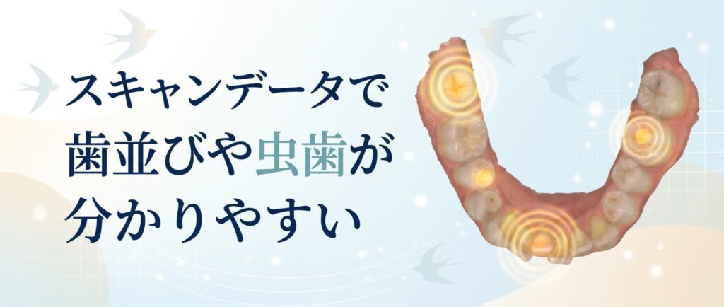 口腔内スキャナーとCTを活用したわかりやすいデジタル歯科診療